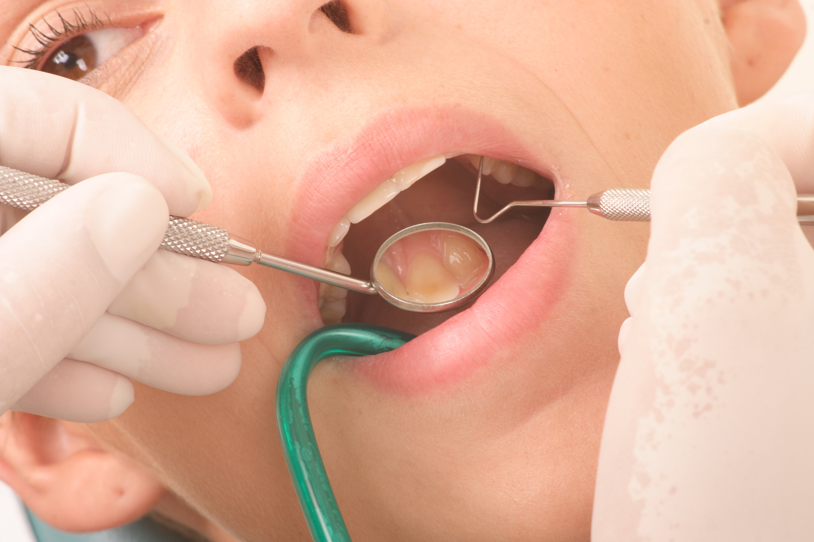 dental services include cleanng, teeth whitening, veneers, crowns, bridges and pediatric dentistry